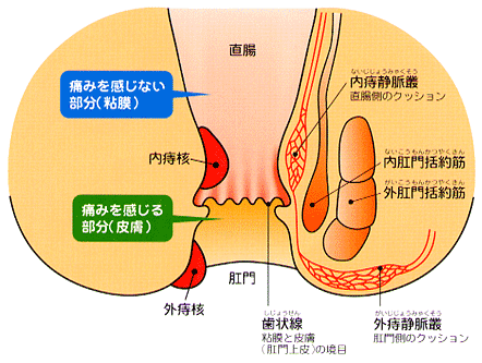 宮岡クリニック ジオン注 痔核治療